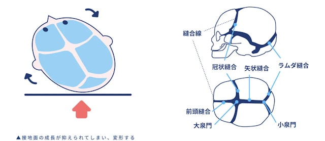 ヘルメット治療が適応になる3つの条件
